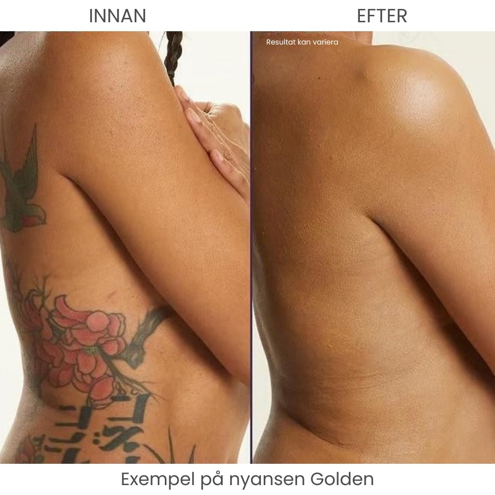 SkinCover™ – Kroppstäckkräm för ytliga blodkärl, åderbråck, ärr, bristningar, tatueringar och andra hudåkommor