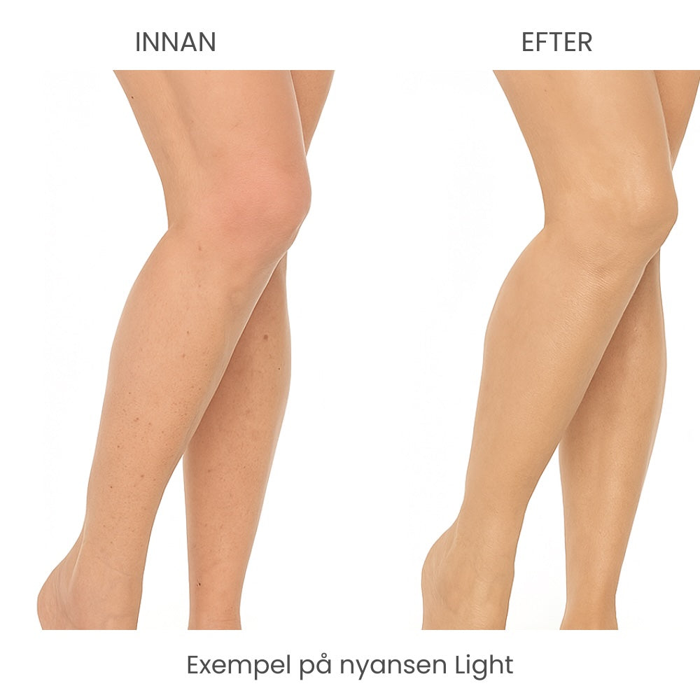 SkinCover™ – Kroppstäckkräm för ytliga blodkärl, åderbråck, ärr, bristningar, tatueringar och andra hudåkommor