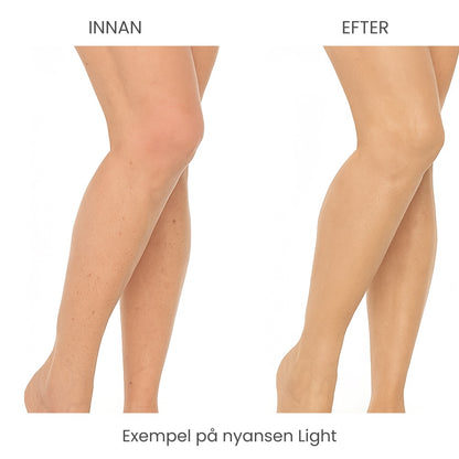 SkinCover™ – Kroppstäckkräm för ytliga spruckna blodkärl, åldersfläckar, ärr, bristningar, blåmärken och andra hudåkommor